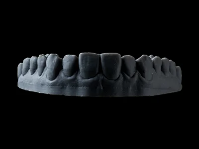 weonelab_3d_printed_dentures.webp