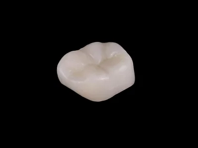 weonelab_3d_printed_dentures_4.webp