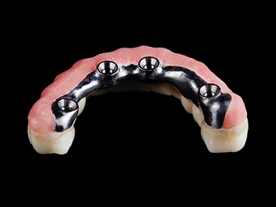 weonelab_bar_all_on_four_dentures_1-1.webp