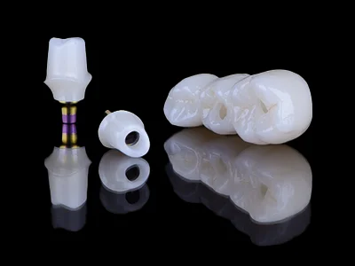 weonelab_custom_abutments_1.webp