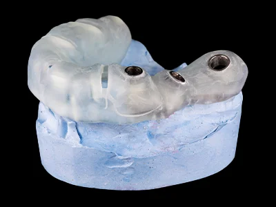 weonelab_dental_surgical_guide_1.webp