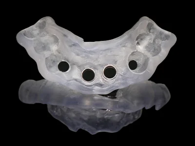 weonelab_dental_surgical_guide_3.webp