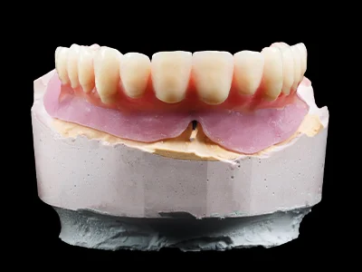 weonelab_product_total_prothesis_1.webp