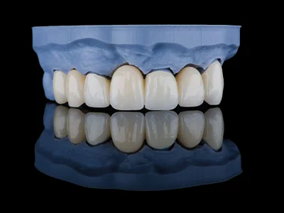 weonelab_zirconium_prothesis.webp