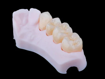 weonelab_zirconium_prothesis_1.webp