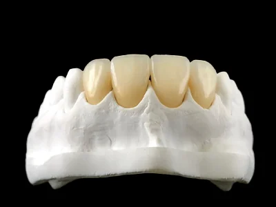 weonelab_zirconium_prothesis_2.webp