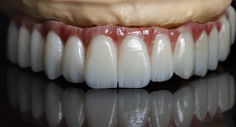 ti base abutment