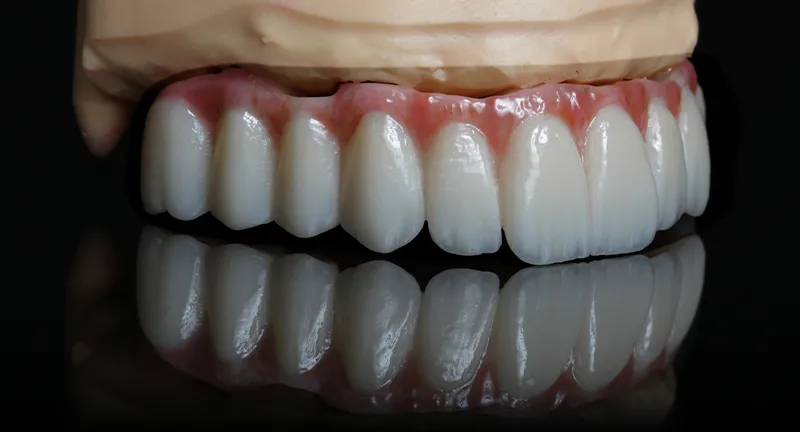 ti base abutment