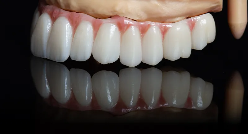 ti-base ankara weonelab diş protez laboratuvarı