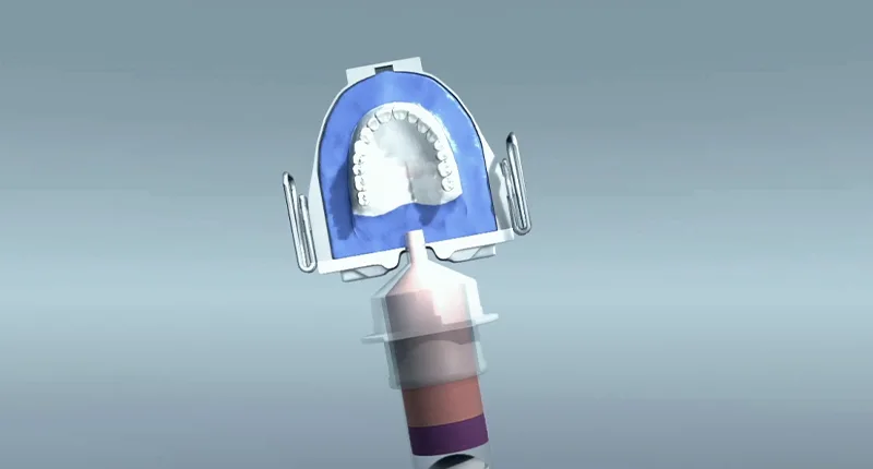 IvoBase Injector Total Diş Protezi Ankara Weonelab Dİş Protez Laboratuvarı