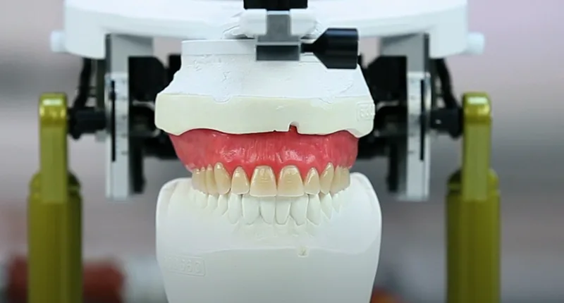 IvoBase Injector Total Diş Protezi Ankara Weonelab Dİş Protez Laboratuvarı